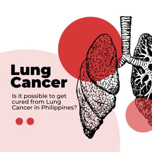 Revolutionizing Non-Small Cell Lung Cancer Treatment in the Philippines: A Guide to Innovative Therapies and Care Options